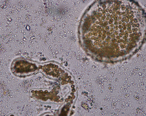 Water quality monitoring-Microcystis counting solution