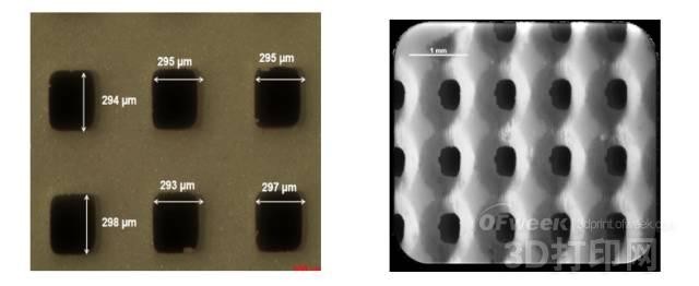 Degradable 3D printed ceramic stent for bone tumor treatment