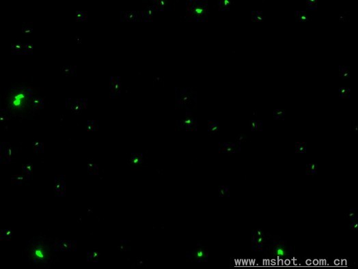 Fluorescent pictures of Bacillus