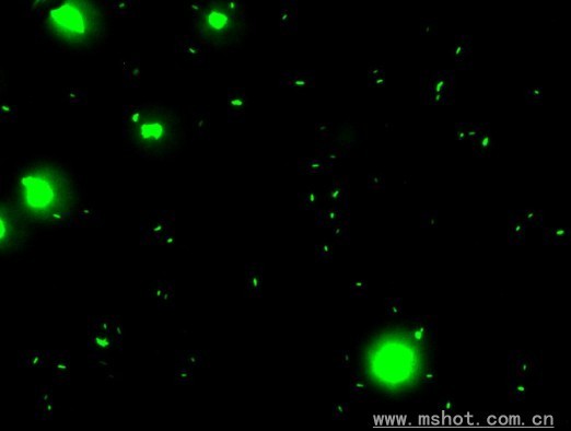 Fluorescent pictures of Bacillus