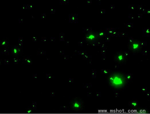 Fluorescent pictures of Bacillus