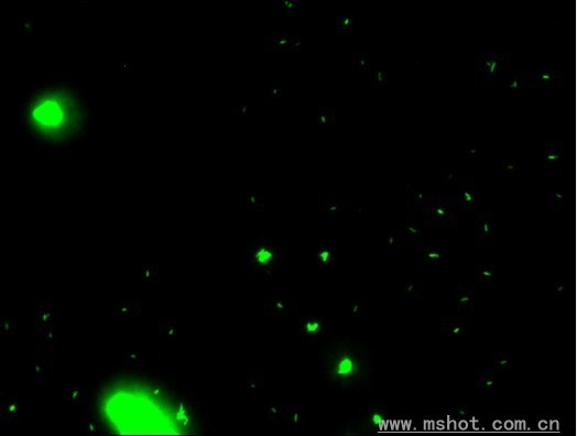 Fluorescent pictures of Bacillus