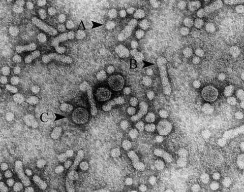 Hepatitis B virus