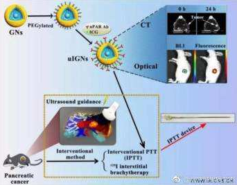 Application and development of ultrasound imaging diagnosis in medicine