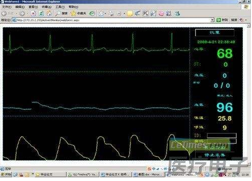 Application of ECG Remote Monitoring System Based on Cloud Computing System