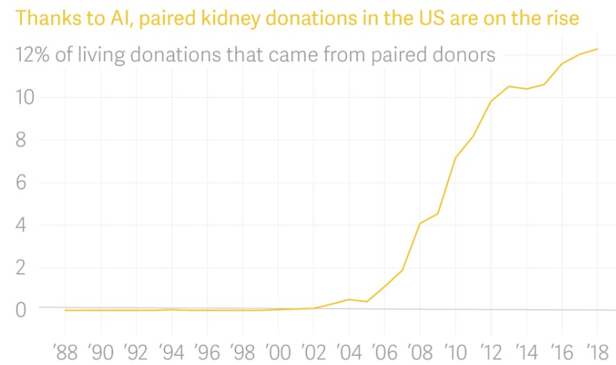 Can AI technology change U.S. organ donation?