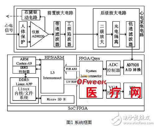 Detailed design of ECG signal detection system based on SoC FPGA