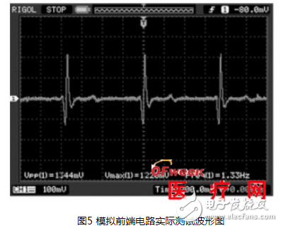 Detailed design of ECG signal detection system based on SoC FPGA