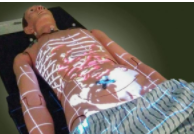 An AR system that displays medical images on a patient