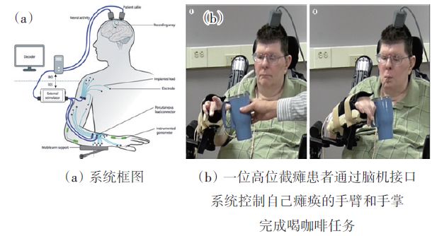 Introduce the achievements of the brain-computer interface in the application system and the current progress and future development trend