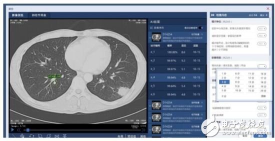 Ping An Technology and Shanxi Provincial Health Planning Commission carry out medical AI cooperation to â€œunlockâ€ new medical quality control model