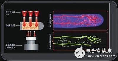 Vein recognition technology, tell you three minutes, it is å•¥