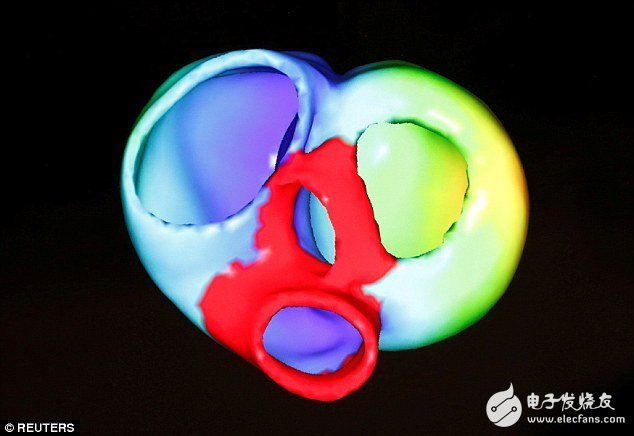 Siemens digitally 3D prints the heart to help doctors diagnose more accurately