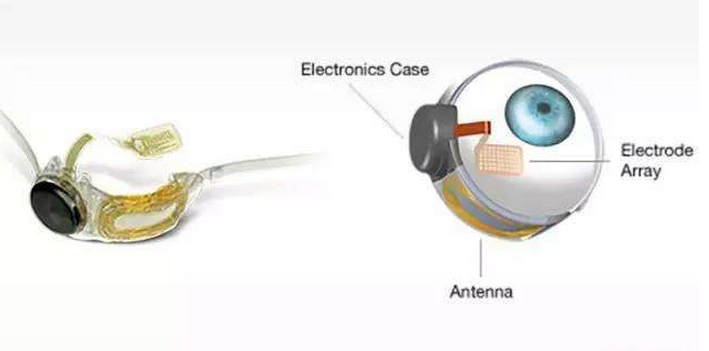 Inventory those creative electronic medical products