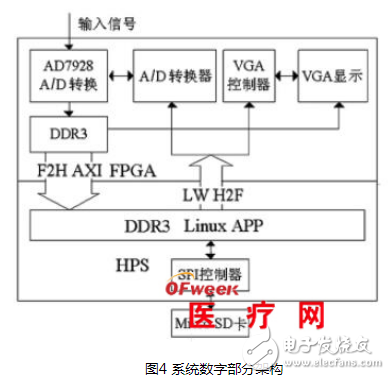 Detailed design of ECG signal detection system based on SoC FPGA