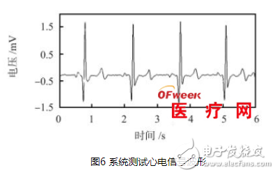 Detailed design of ECG signal detection system based on SoC FPGA