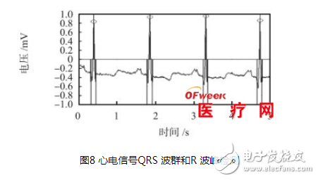 Detailed design of ECG signal detection system based on SoC FPGA