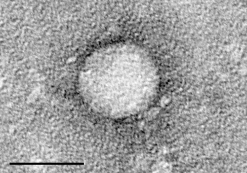 CDC current guidelines may miss HCV infection cases