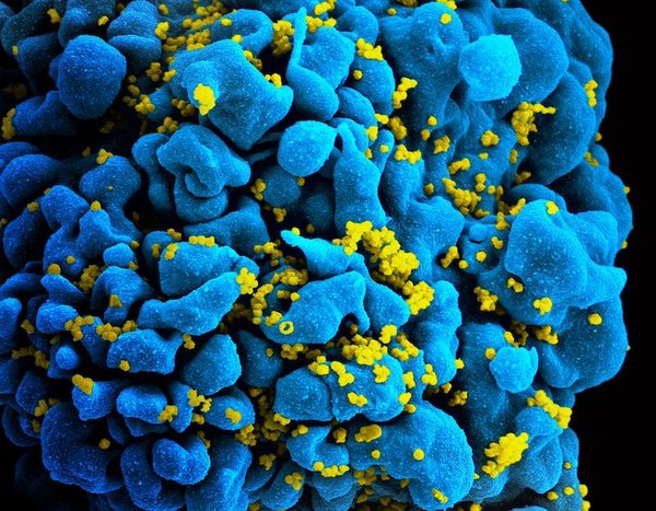 Science Supplement: New Discovery Provides New Ideas for Improving HIV and Hepatitis C Vaccine