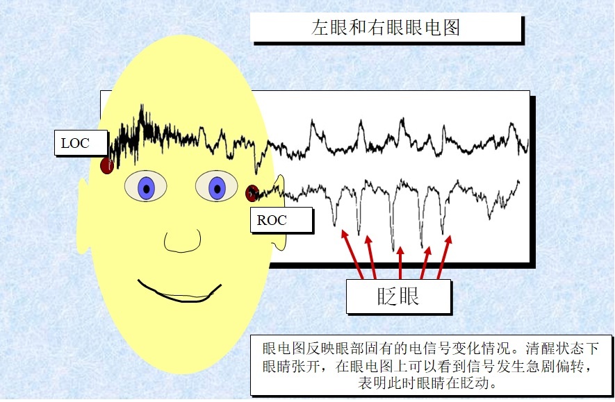 REM and sleep medicine history and sleep physiology