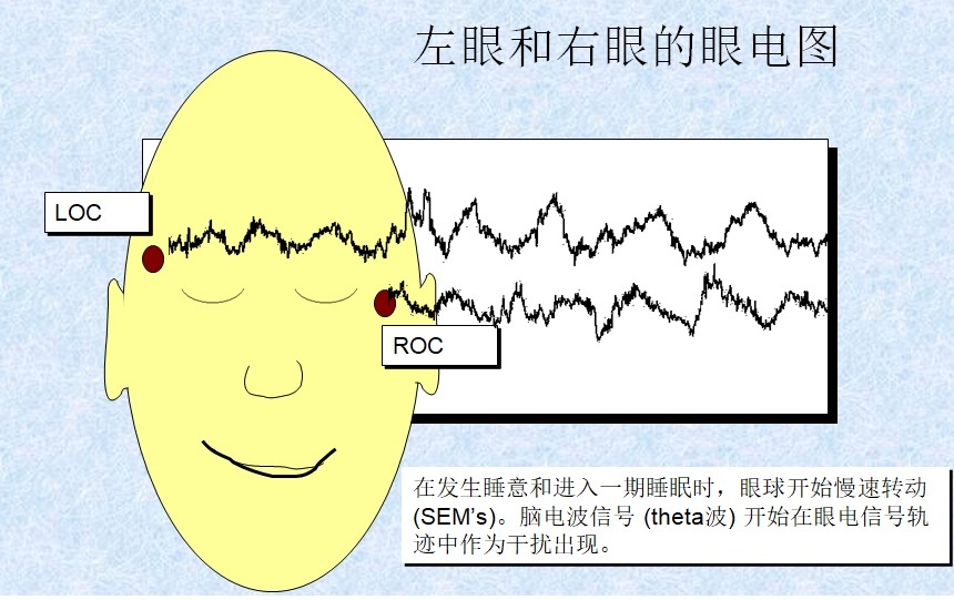 REM and sleep medicine history and sleep physiology