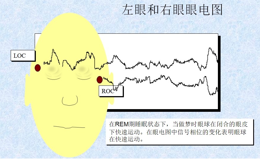REM and sleep medicine history and sleep physiology