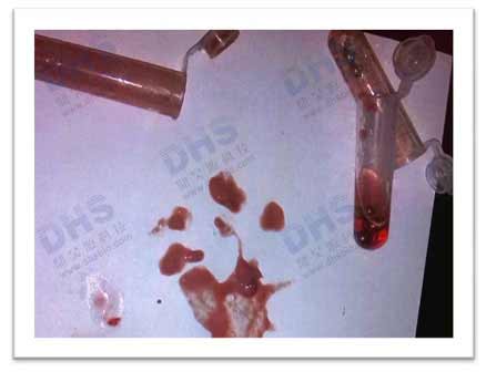 Real-time shot of the effect of broken heart and lung tissue (using ordinary 5ml centrifuge tube)