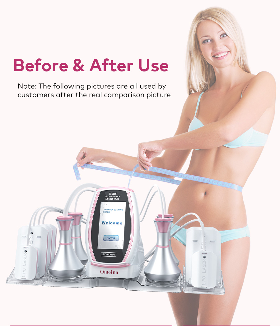 Omeina 6 in 1 rf machine Omeina 6 in 1 rf machine