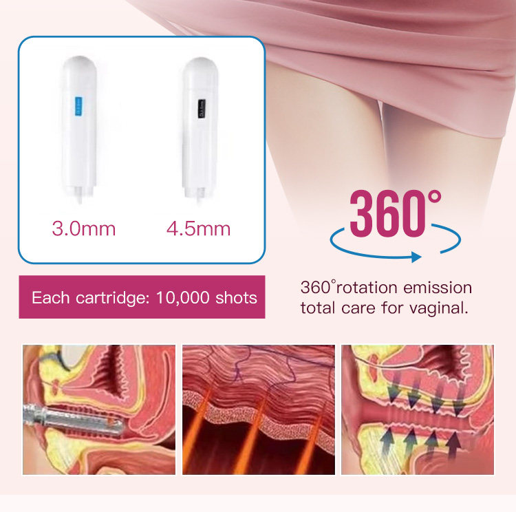 hifu ultrasound hifu ultrasound
