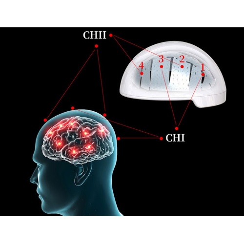 Nerve Stimulation PBM Helmet For Brain Diseases Treatment for Sale, Nerve Stimulation PBM Helmet For Brain Diseases Treatment wholesale From China