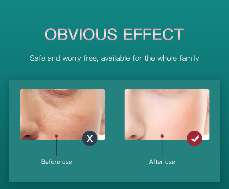 Red Light Therapy for Face LED Light Therapy2(14) Red Light Therapy for Face LED Light Therapy2(14)