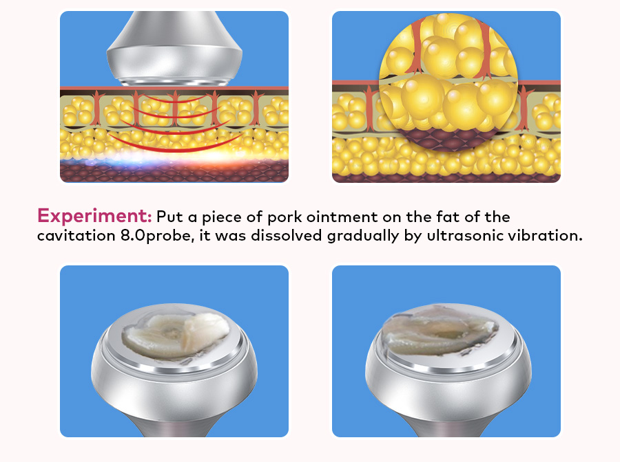 fat reduction therapy fat reduction therapy