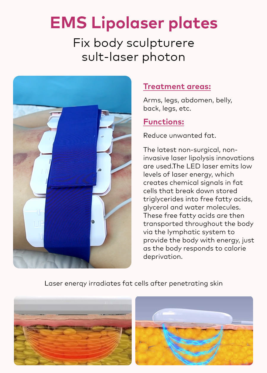 laser lipolysis laser lipolysis
