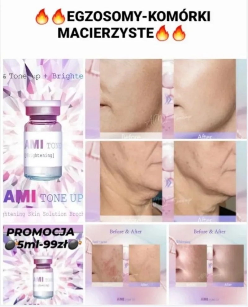 Korea-Original-Ami-Tone-up-Vegan-Exosomes-Niacinamide-Tranexamic-Acid-Skin-Booster-Pn-Exosome-Injection-Exosomes-Skincare-Pdrn-Mesotherapy-Whitening Korea-Original-Ami-Tone-up-Vegan-Exosomes-Niacinamide-Tranexamic-Acid-Skin-Booster-Pn-Exosome-Injection-Exosomes-Skincare-Pdrn-Mesotherapy-Whitening