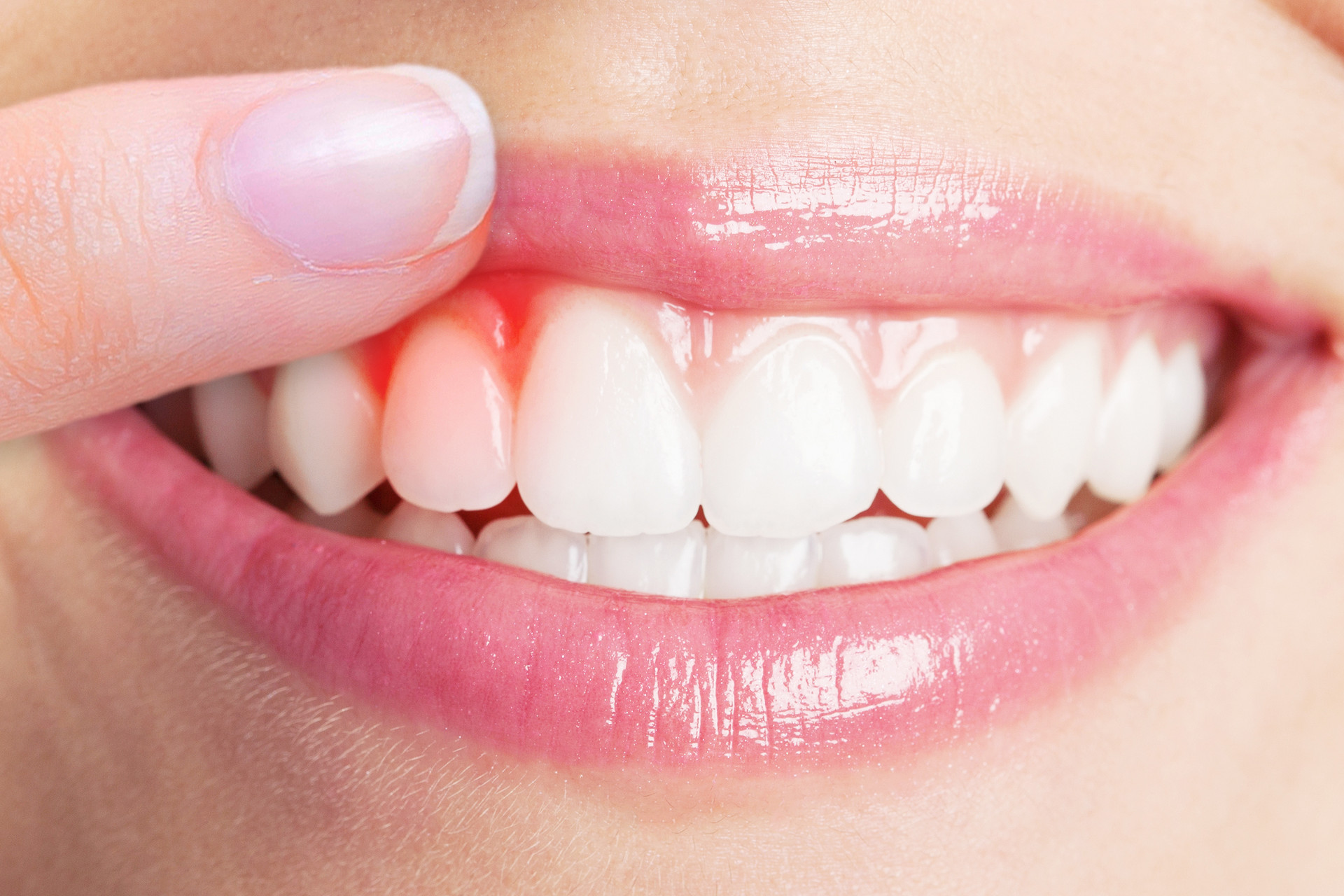 Oral Health Oral Health