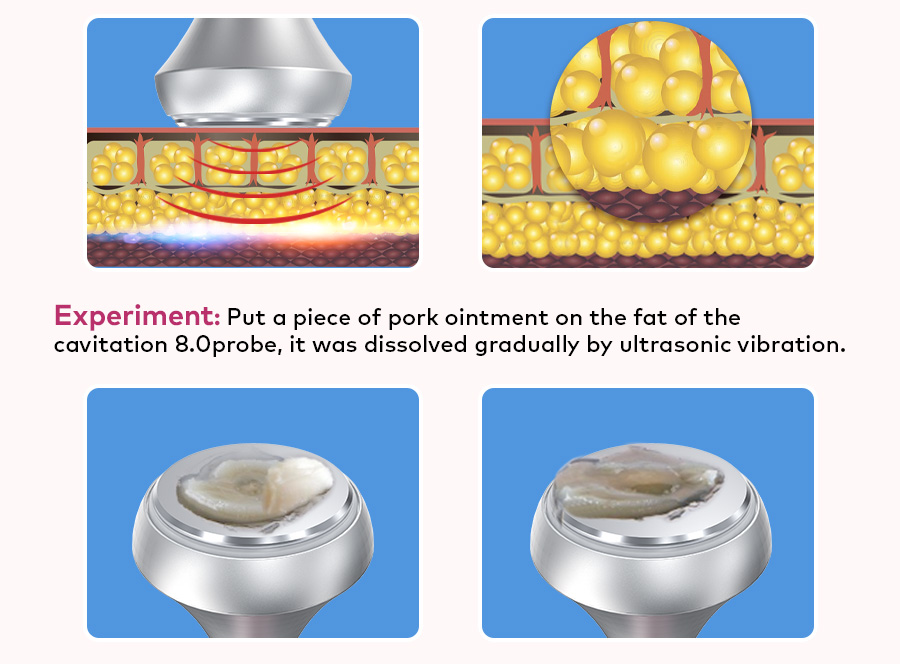 abdomen skin tightening abdomen skin tightening