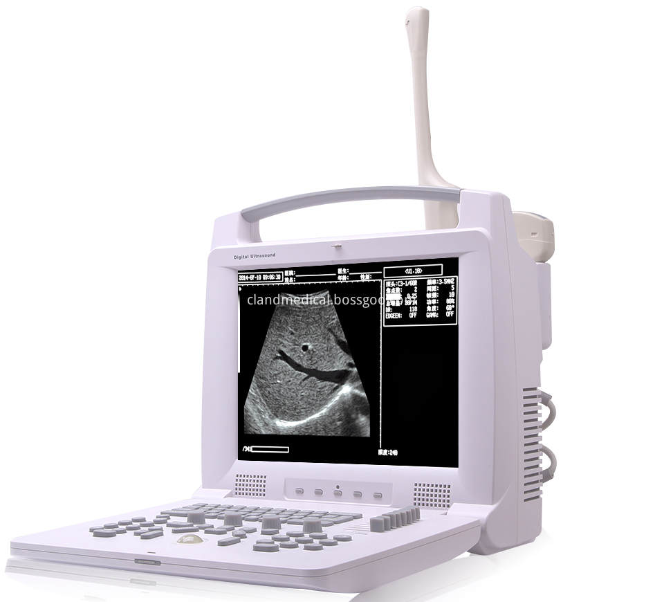 Pl 3018i Full Digital Portable Ultrasound Scanner 18 Pl 3018i Full Digital Portable Ultrasound Scanner 18