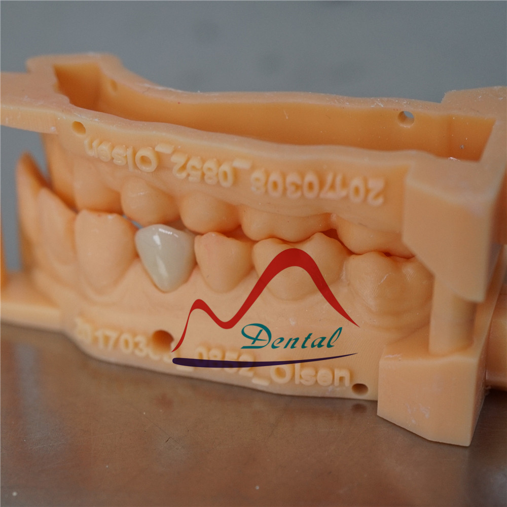 Dental Digital printed model for Emax crown(id10437700). Buy China