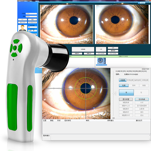 body scanner biometric eye iris iridology iriscope camera for Sale, body scanner biometric eye iris iridology iriscope camera wholesale From China