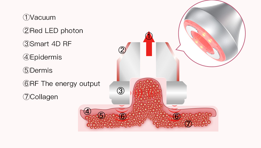 cavitation vacuum cavitation vacuum