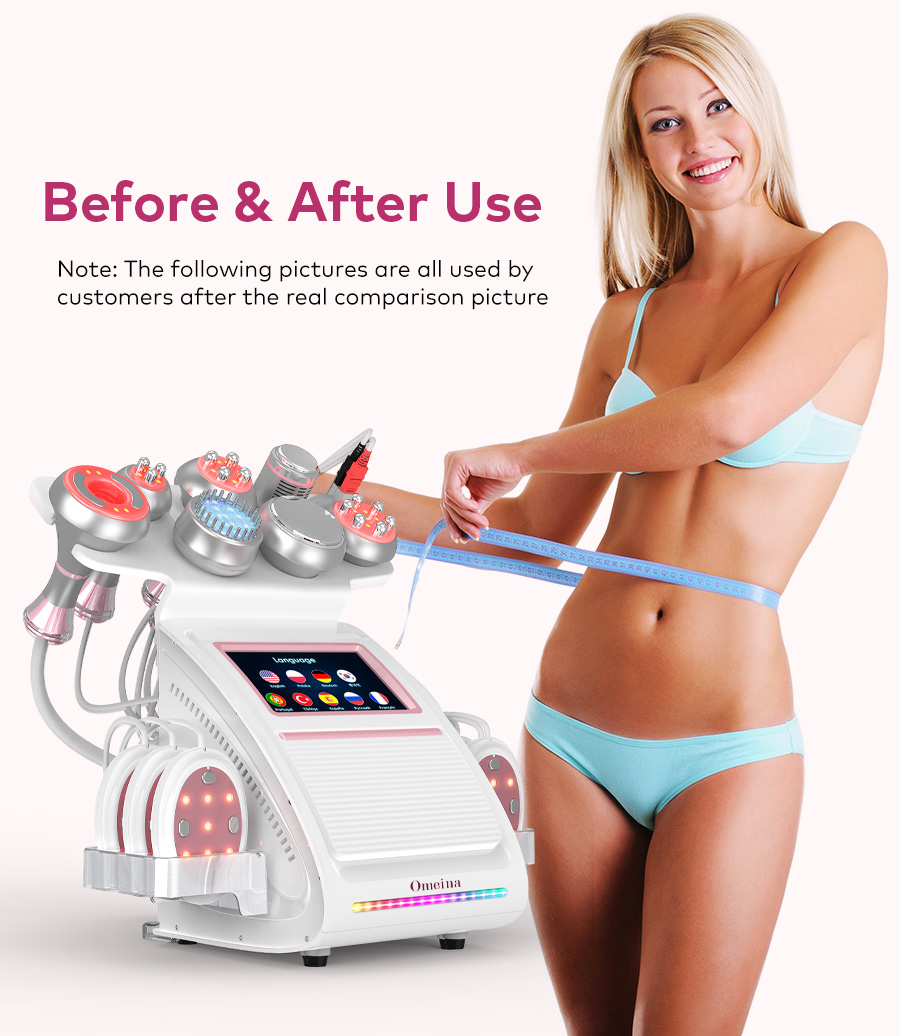 Omeina ultrasound fat cavitation machine Omeina ultrasound fat cavitation machine