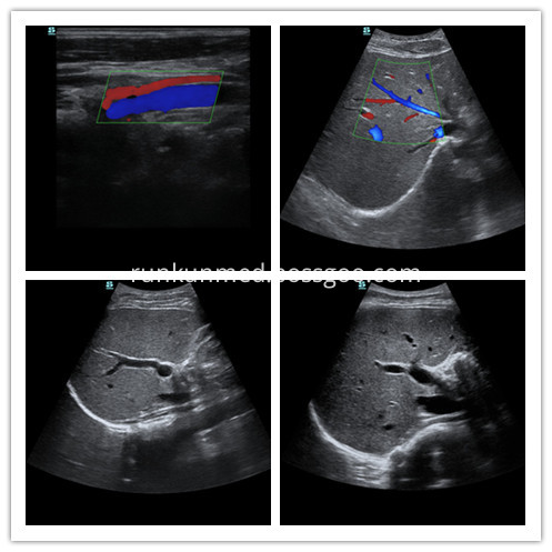 Doppler Ultrasound Doppler Ultrasound