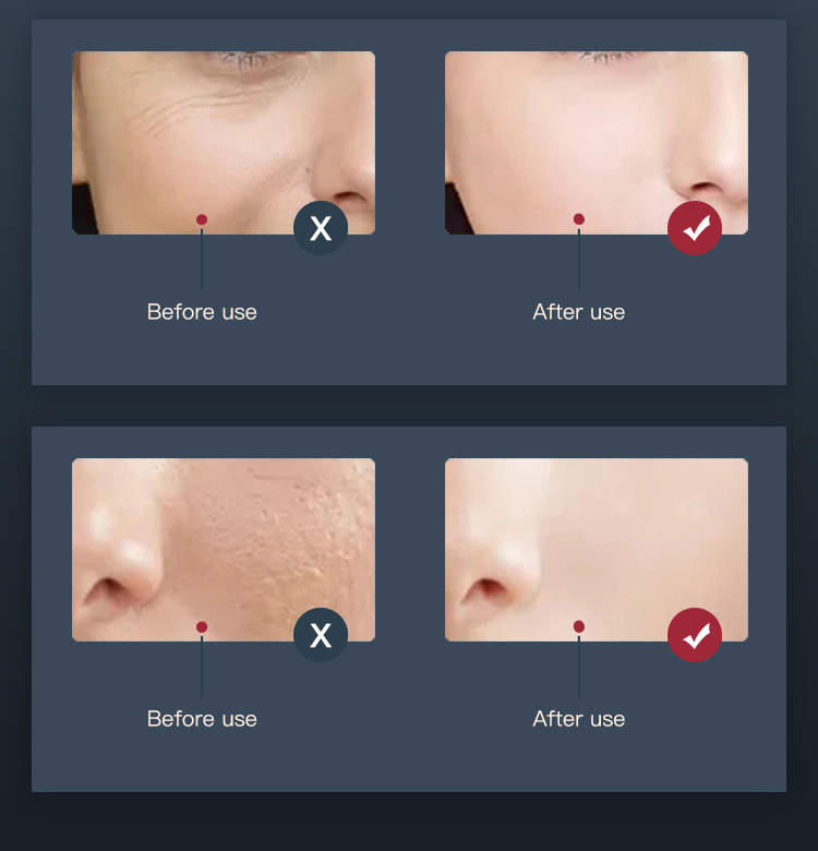 led face light therapy led face light therapy