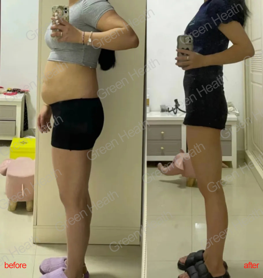 Weight Loss Effect 14 Weight Loss Effect 14