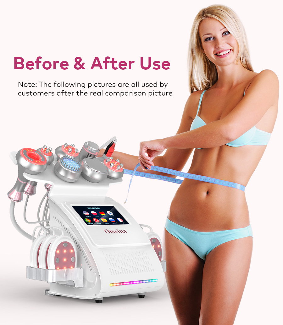 Omeina nine in one cavitation machine with ems Omeina nine in one cavitation machine with ems