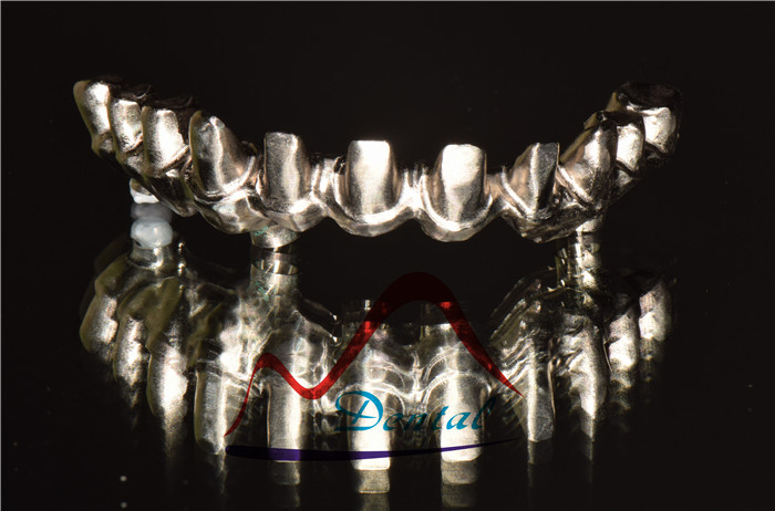 Nobel Dental Implant Bridge (1)