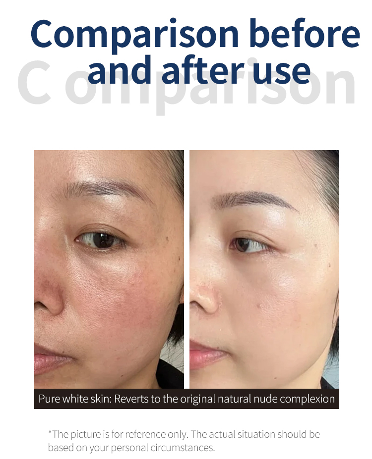 High-Pressure Skin Infusion High-Pressure Skin Infusion