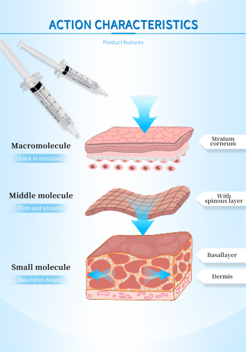 Hyaluronic acid filler 3 Hyaluronic acid filler 3