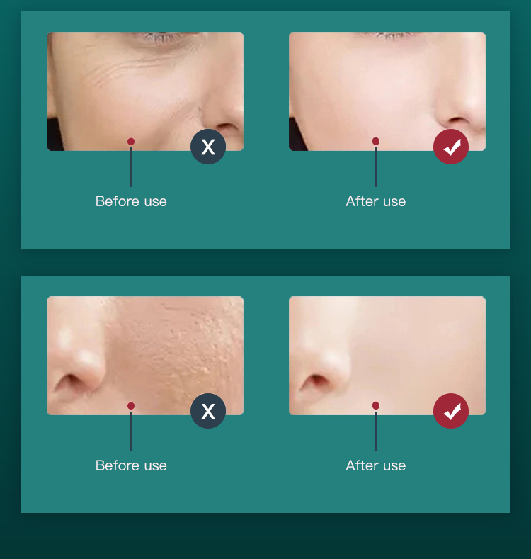 Red Light Therapy for Face LED Light Therapy2(15) Red Light Therapy for Face LED Light Therapy2(15)