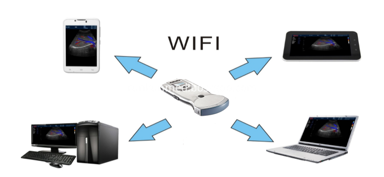 Convex Probe Color Ultrasound Imaging System Convex Probe Color Ultrasound Imaging System